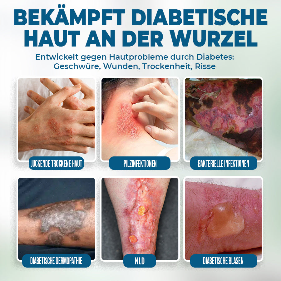 🟨NEGUSY™ Hautpflege speziell für Diabetiker