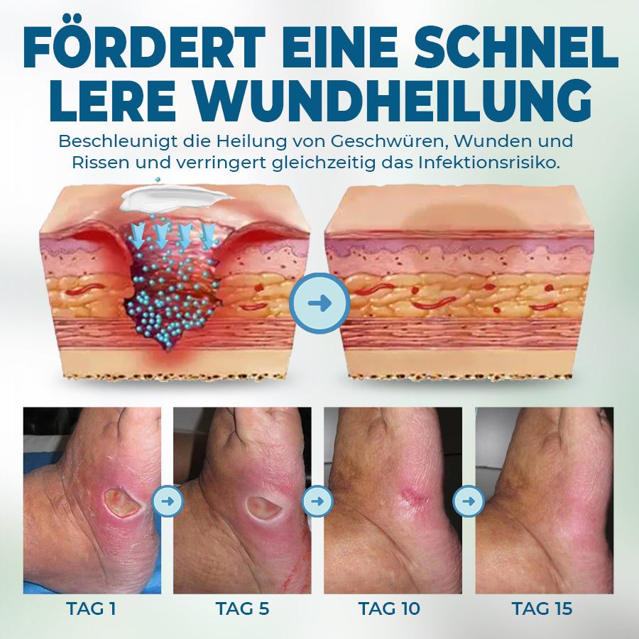 🟨NEGUSY™ Hautpflege speziell für Diabetiker