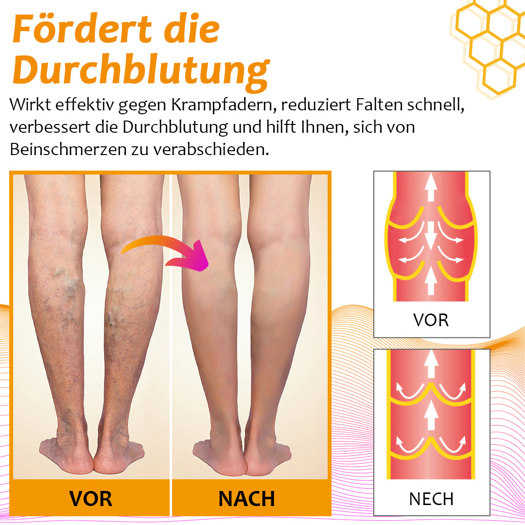 Letzter Tag 50% RabattđProShiny⢠CelluSmooth Venenentlastungs-Leggings
