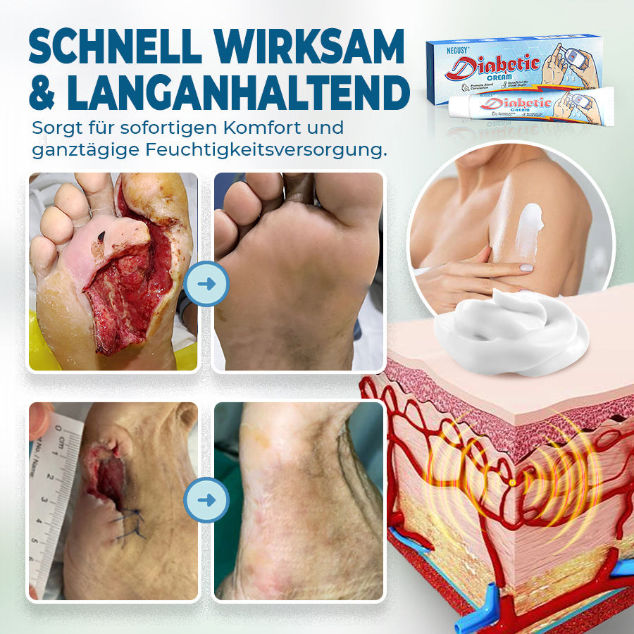 🟨NEGUSY™ Hautpflege speziell für Diabetiker