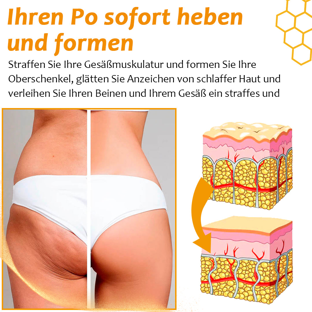 Letzter Tag 50% RabattđProShiny⢠CelluSmooth Venenentlastungs-Leggings