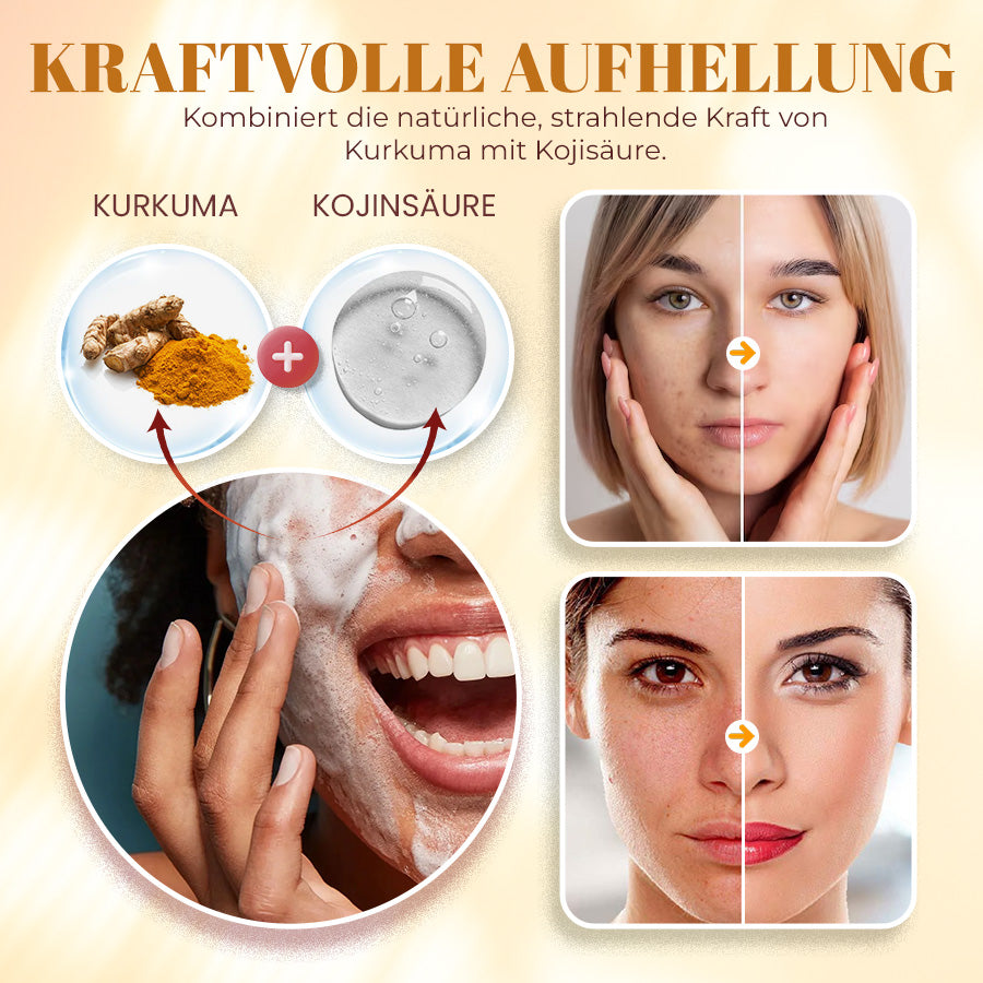 🟨NEGUSY™ Kurkuma & Kojisäure – Hautaufhellende Seife