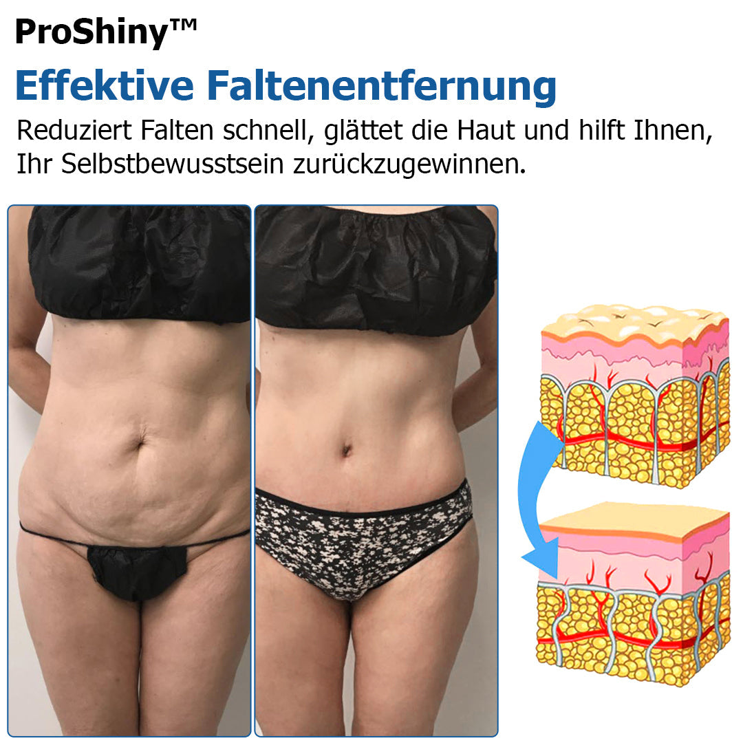 Letzter Tag 55% Rabatt⭐ProShiny™ Kompression Körperformung Set