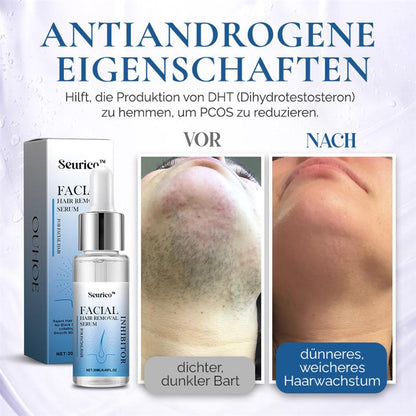 🌿Natürliche Behandlung zu Hause für Gesichtsbehaarung bei PCOS