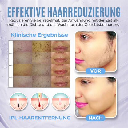 🌿Natürliche Behandlung zu Hause für Gesichtsbehaarung bei PCOS