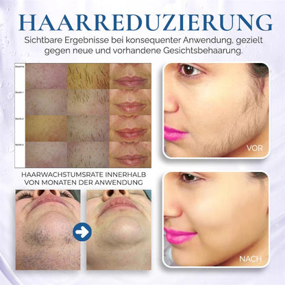 🌿Natürliche Behandlung zu Hause für Gesichtsbehaarung bei PCOS