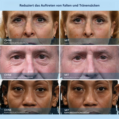 🟩LBMLBM™ Serum zur schnellen Faltenreduzierung