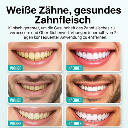 Seurico™ Bright Clean