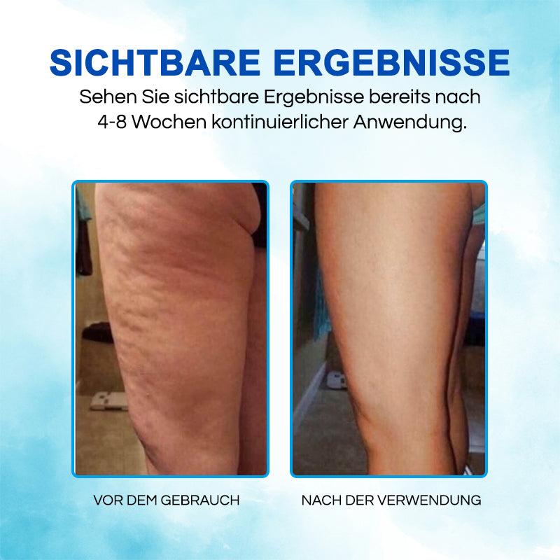 ✨ProShiny™ CelluBliss Hosen - Hergestellt in Deutschland