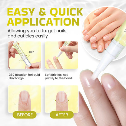 NEGUSY Rejuvenation Nail Growth Oil